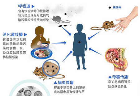 流行性出血熱你了解多少？